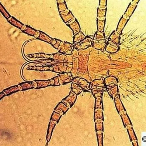 thumbnail for publication: Tropical Fowl Mite, Ornithonyssus bursa (Berlese) (Arachnida: Acari: Macronyssidae)